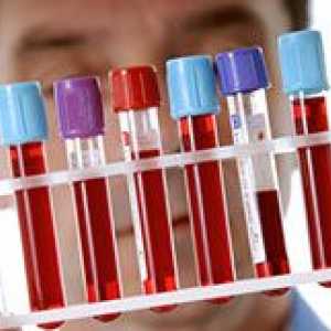Un test de sange pentru sifilis