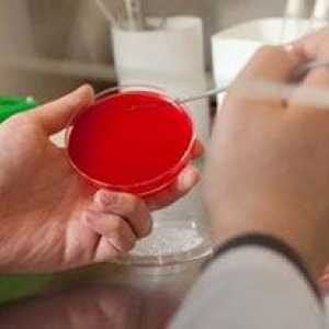 Analiza urinei pentru însămânțare