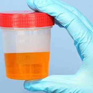 Analiza urinei la copii