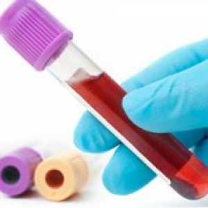 Teste Cdat pentru hepatita