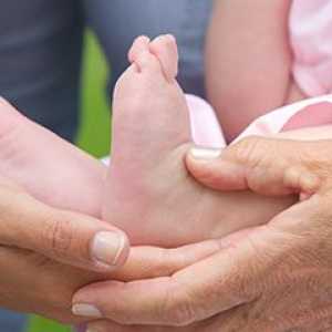Picior deformare la copii