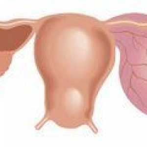 Chisturile ovariene foliculare - cauze, simptome și tratament