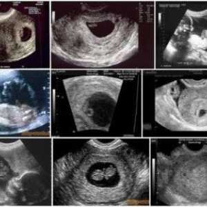 Fotografie de săptămâni de sarcină cu ultrasunete