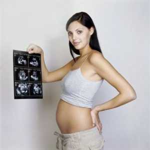 Fotografii cu ultrasunete 20 de săptămâni gravidă