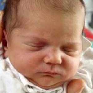 Hematom pe capul unui nou-născut - în cazul în care există și cum să-l eliminați?