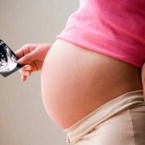 Hidronefroză în timpul sarcinii