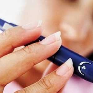 Glucoză în timpul sarcinii: norma si patologie