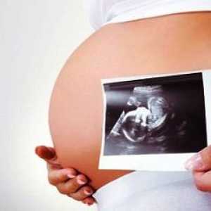 Cum de a identifica sindromul Down în timpul sarcinii