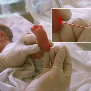Care este rata de bilirubina in sange de nou-născut
