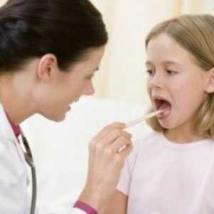 Mononucleoza la copii: simptome si tratament