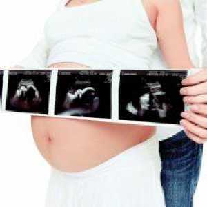 Greutatea normala fetale în 26 de săptămâni de sarcină
