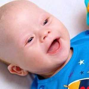 Bebelușii cu sindromul Down