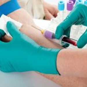 Generale și biochimice teste de sânge la adulți
