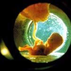 Lichid amniotic in timpul sarcinii: valoarea. Scurgerea și ruperea prematură a membranelor: cauze,…