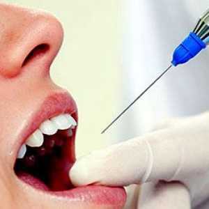 Boala parodontala - Simptome si tratament