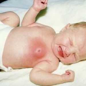 De ce nou-născut mărit sânii?