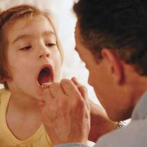 Tratamentul adecvat al gâtului la copii cu vârsta de 2 până la 5 ani