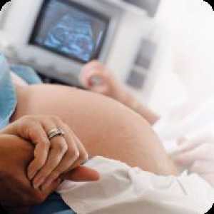 Diagnosticul prenatal de fetale