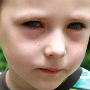 Cauzele pungile de sub ochii copilului și eliminarea acestora