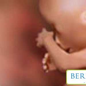 Motivele pentru dezvoltarea sarcinii