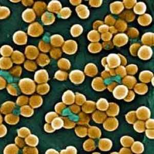Semne de Staphylococcus aureus