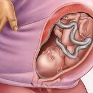 Amplasarea fătului în timpul sarcinii
