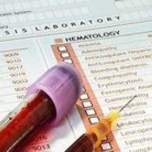Descifrarea testul de sânge pentru femei