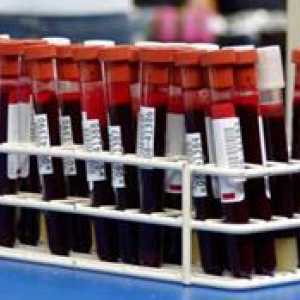 Decodarea testelor de sânge la copii