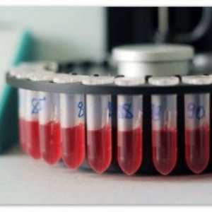 Descifrarea rezultatele testelor de sânge la copii