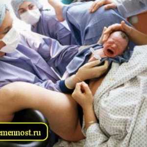 Naștere după cezariană
