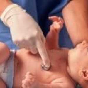 Murmur cardiac la nou-născuți