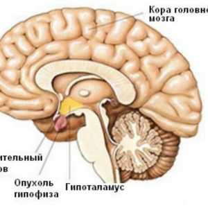 Simptomele si tratamentul tumorilor cerebrale la copii