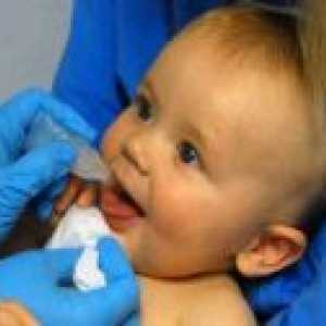 Simptomele gripei intestinale la copil