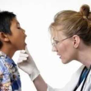 Simptomele de mononucleoza la copii