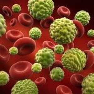Simptomele de cancer de sânge la copii și adulți
