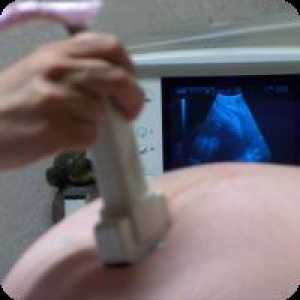 De câte ori fac ecografie în timpul sarcinii?