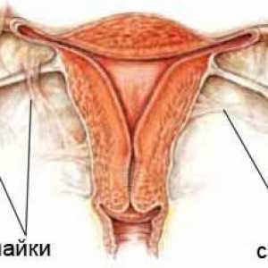 Adeziuni în trompele uterine: motivele educației, metode de tratament