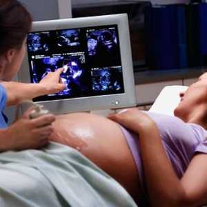 Al treilea screening-ul în timpul sarcinii, calendarul