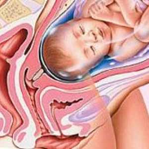 Cervixul scurt în timpul sarcinii