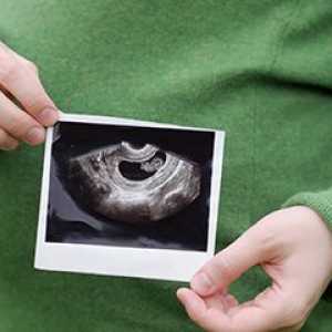 Uzi in timpul sarcinii: cronologia