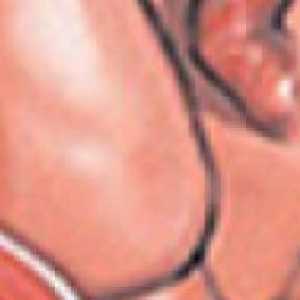 Ce se schimbă colul uterin înainte de travaliu