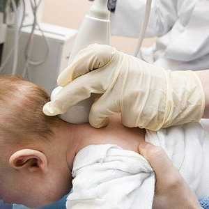 În unele cazuri, un copil ultrasonografie craniană?