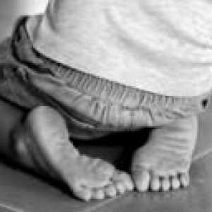 Valgus picior deformare la copii
