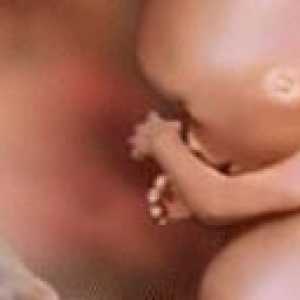 Hipoxie fetală intrauterină
