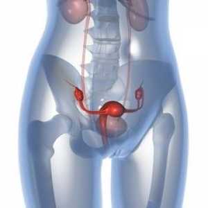 Este posibil sarcina cu ovare polichistice?