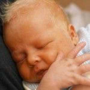 Icter la nou-nascuti: normal sau boala? Simtomy, cauze si tratament