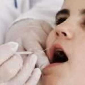 Durere de dinți la copii